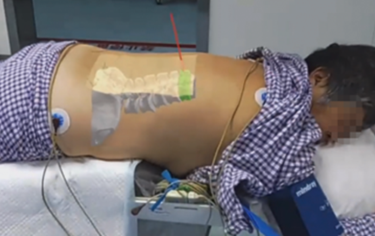 手术导航与体表定位